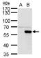 Bifunctional polynucleotide phosphatase/kinase antibody, GTX129606, GeneTex, Western Blot image 