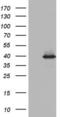 Ubiquitin Recognition Factor In ER Associated Degradation 1 antibody, LS-C339134, Lifespan Biosciences, Western Blot image 