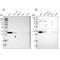 Caspase 6 antibody, NBP1-87683, Novus Biologicals, Western Blot image 