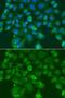 Cystatin SN antibody, LS-C748347, Lifespan Biosciences, Immunofluorescence image 