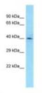 Cytochrome C1 antibody, NBP1-98425, Novus Biologicals, Western Blot image 