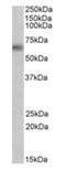 Monoamine Oxidase B antibody, orb19200, Biorbyt, Western Blot image 