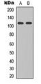 Glutamate Ionotropic Receptor Delta Type Subunit 2 antibody, GTX56101, GeneTex, Western Blot image 