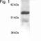 Methyl-CpG Binding Protein 2 antibody, NB600-1101, Novus Biologicals, Western Blot image 