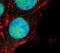 Forkhead Box O3 antibody, MA5-14932, Invitrogen Antibodies, Immunofluorescence image 