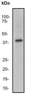 Interleukin 18 Binding Protein antibody, TA303770, Origene, Western Blot image 