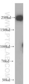 Ubiquitin Specific Peptidase 32 antibody, 18838-1-AP, Proteintech Group, Western Blot image 