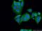SCH antibody, 21686-1-AP, Proteintech Group, Immunofluorescence image 