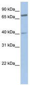 Afadin- and alpha-actinin-binding protein antibody, TA335636, Origene, Western Blot image 