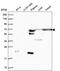 Ankyrin Repeat Domain 55 antibody, PA5-62303, Invitrogen Antibodies, Western Blot image 