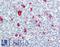 BTB Domain Containing 6 antibody, LS-B8429, Lifespan Biosciences, Immunohistochemistry frozen image 