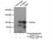 Aldehyde Dehydrogenase 1 Family Member L1 antibody, 17390-1-AP, Proteintech Group, Immunoprecipitation image 