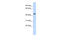 Jumonji Domain Containing 4 antibody, ARP33301_P050, Aviva Systems Biology, Western Blot image 