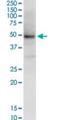 NAD(P) Dependent Steroid Dehydrogenase-Like antibody, H00050814-M01, Novus Biologicals, Western Blot image 