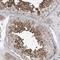 SOGA Family Member 3 antibody, NBP1-90575, Novus Biologicals, Immunohistochemistry paraffin image 