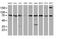 SPG7 Matrix AAA Peptidase Subunit, Paraplegin antibody, MA5-25909, Invitrogen Antibodies, Western Blot image 