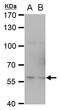 TNF Receptor Associated Factor 6 antibody, GTX113029, GeneTex, Western Blot image 