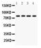 Protein Kinase C Eta antibody, PB9556, Boster Biological Technology, Western Blot image 
