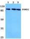 Proteasome 26S Subunit, Non-ATPase 2 antibody, A06642, Boster Biological Technology, Western Blot image 