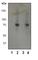 Bruton Tyrosine Kinase antibody, ab40770, Abcam, Western Blot image 