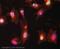 Aurora Kinase B antibody, ab2254, Abcam, Immunocytochemistry image 