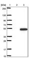 TBC1 Domain Family Member 20 antibody, PA5-60437, Invitrogen Antibodies, Western Blot image 