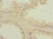 Zic Family Member 3 antibody, LS-C676744, Lifespan Biosciences, Immunohistochemistry paraffin image 