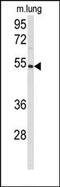 Prostaglandin I2 Synthase antibody, AP14903PU-N, Origene, Western Blot image 