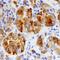 Sulfotransferase Family 2B Member 1 antibody, PA5-47819, Invitrogen Antibodies, Immunohistochemistry paraffin image 