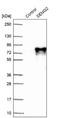 Semenogelin 2 antibody, NBP1-92376, Novus Biologicals, Western Blot image 