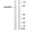 Adenosine Deaminase RNA Specific B1 antibody, A01810, Boster Biological Technology, Western Blot image 