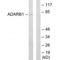 Double-stranded RNA-specific editase 1 antibody, A01810, Boster Biological Technology, Western Blot image 