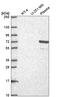Nuclear Factor Of Activated T Cells 1 antibody, HPA071732, Atlas Antibodies, Western Blot image 