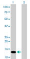 FKBP Prolyl Isomerase 1A antibody, LS-C197224, Lifespan Biosciences, Western Blot image 