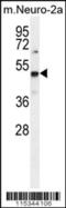 Protein Arginine Methyltransferase 1 antibody, 55-010, ProSci, Western Blot image 