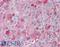 DNA Methyltransferase 3 Beta antibody, LS-B1191, Lifespan Biosciences, Immunohistochemistry frozen image 