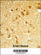DEAD-Box Helicase 17 antibody, 63-895, ProSci, Immunohistochemistry paraffin image 