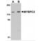 Myosin Binding Protein C, Fast Type antibody, MBS151543, MyBioSource, Western Blot image 