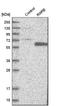 Retinoic Acid Receptor Beta antibody, HPA004174, Atlas Antibodies, Western Blot image 