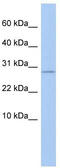 Ankyrin Repeat Domain 7 antibody, TA335935, Origene, Western Blot image 