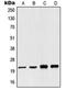 NADH:Ubiquinone Oxidoreductase Subunit B10 antibody, orb214297, Biorbyt, Western Blot image 