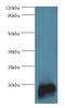 Troponin C2, Fast Skeletal Type antibody, LS-B15211, Lifespan Biosciences, Western Blot image 