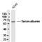 Albumin antibody, GTX60252, GeneTex, Western Blot image 
