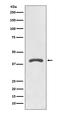 Angiotensin II Receptor Type 2 antibody, M00432, Boster Biological Technology, Western Blot image 