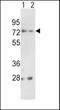 Neuroendocrine convertase 2 antibody, 63-051, ProSci, Western Blot image 