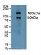 Gelsolin antibody, LS-C294188, Lifespan Biosciences, Western Blot image 