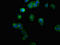 Protein Phosphatase, Mg2+/Mn2+ Dependent 1F antibody, LS-C671057, Lifespan Biosciences, Immunofluorescence image 