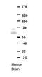 Protein downstream neighbor of Son antibody, A12549, Boster Biological Technology, Western Blot image 