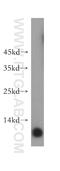 CDC28 Protein Kinase Regulatory Subunit 2 antibody, 15616-1-AP, Proteintech Group, Western Blot image 