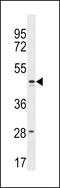 Family With Sequence Similarity 155 Member B antibody, 59-894, ProSci, Western Blot image 